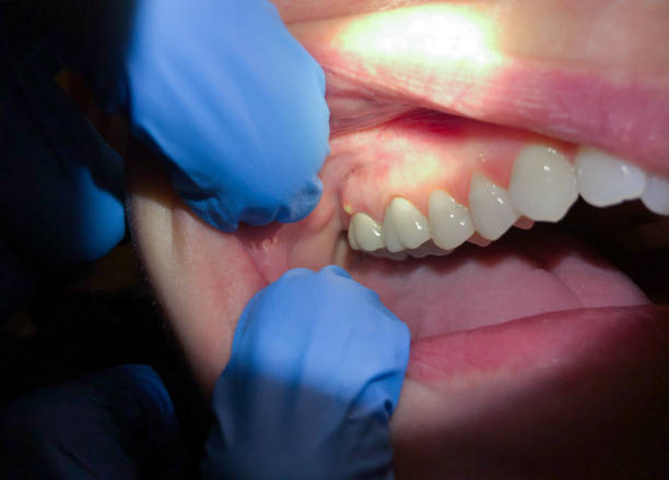 Best Emergency Dental Care for Trauma or Injury in Newk, AR